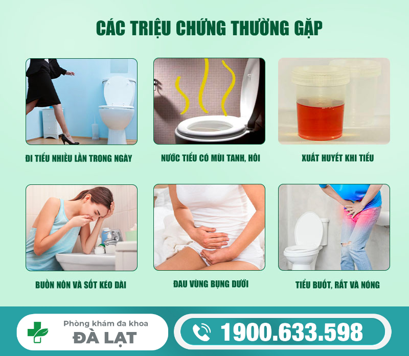 Hình ảnh minh họa